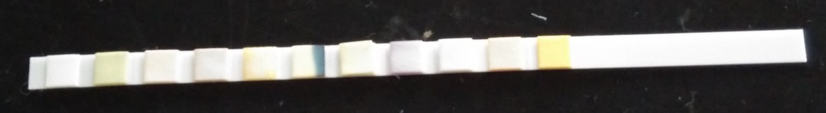 尿液检查